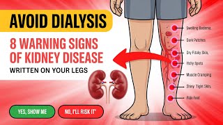 Prevent Dialysis: 8 Leg Symptoms That May Signal Kidney Disease