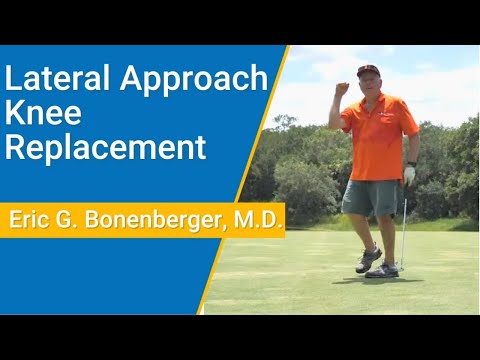 Lateral Approach Knee Replacement | Eric G. Bonenberger, M.D.