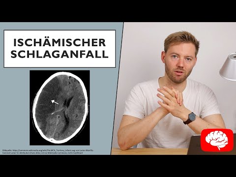 Ischemic Stroke - Basics of Neurology