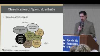 Medical Management of Spondyloarthritis Presented by Liron Caplan, MD PhD