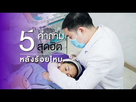 ร้อยไหม หน้าเรียว