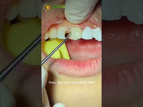 ✨ Healthy teeth, confident smile!