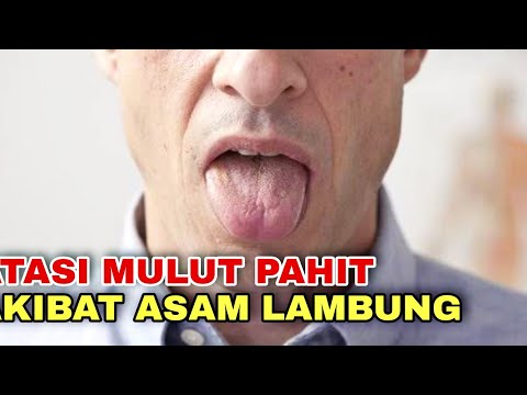 Cara Mengatasi Mulut Pahit Karena Asam Lambung