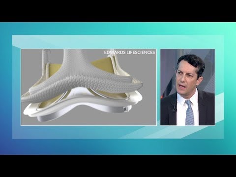 Edwards Lifesciences Extends Gains After Earnings Gap