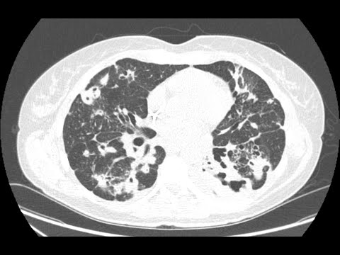 STR Cardiothoracic Case Webinar 10/21/2021