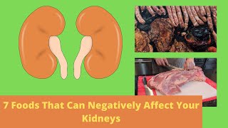 7 Foods That Can Negatively Affect Your Kidneys
