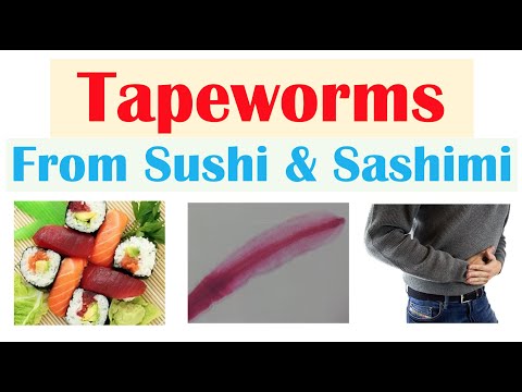 Schistosomiasis Bilharziasis Causes Symptoms and Treatment