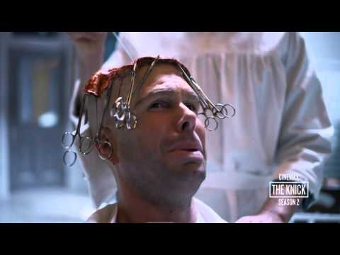 The Knick Season 2: Body Shop  Brain Surgery (Cinemax)