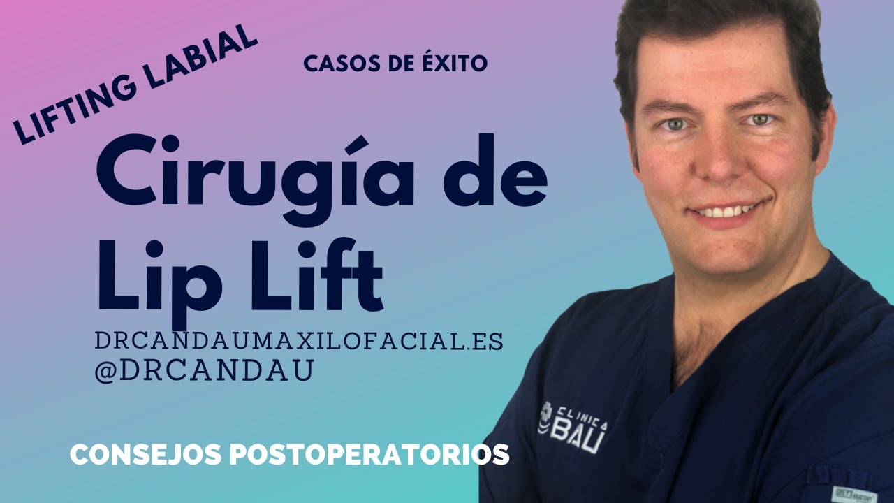 Alberto Candau Álvarez-45