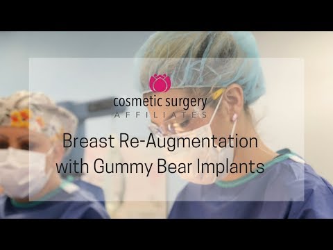 download lagu mp3 mp4 Gummy Bear Breast Implants Before And After, download lagu Gummy Bear Breast Implants Before And After gratis, unduh video klip Gummy Bear Breast Implants Before And After