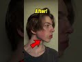 How to get a jawline
