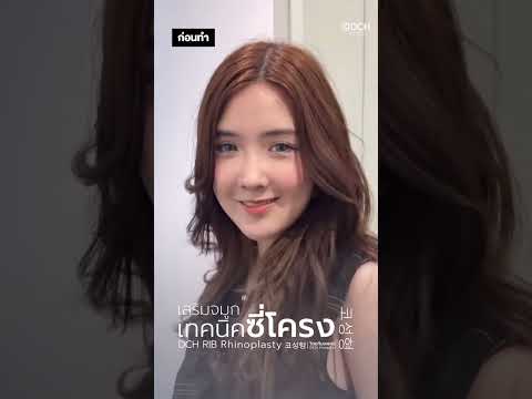 ทรงจมูก เบียร์ The Voice