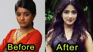 Dark Skin Tv Actress Before &amp; After | Unbelievable Transformation