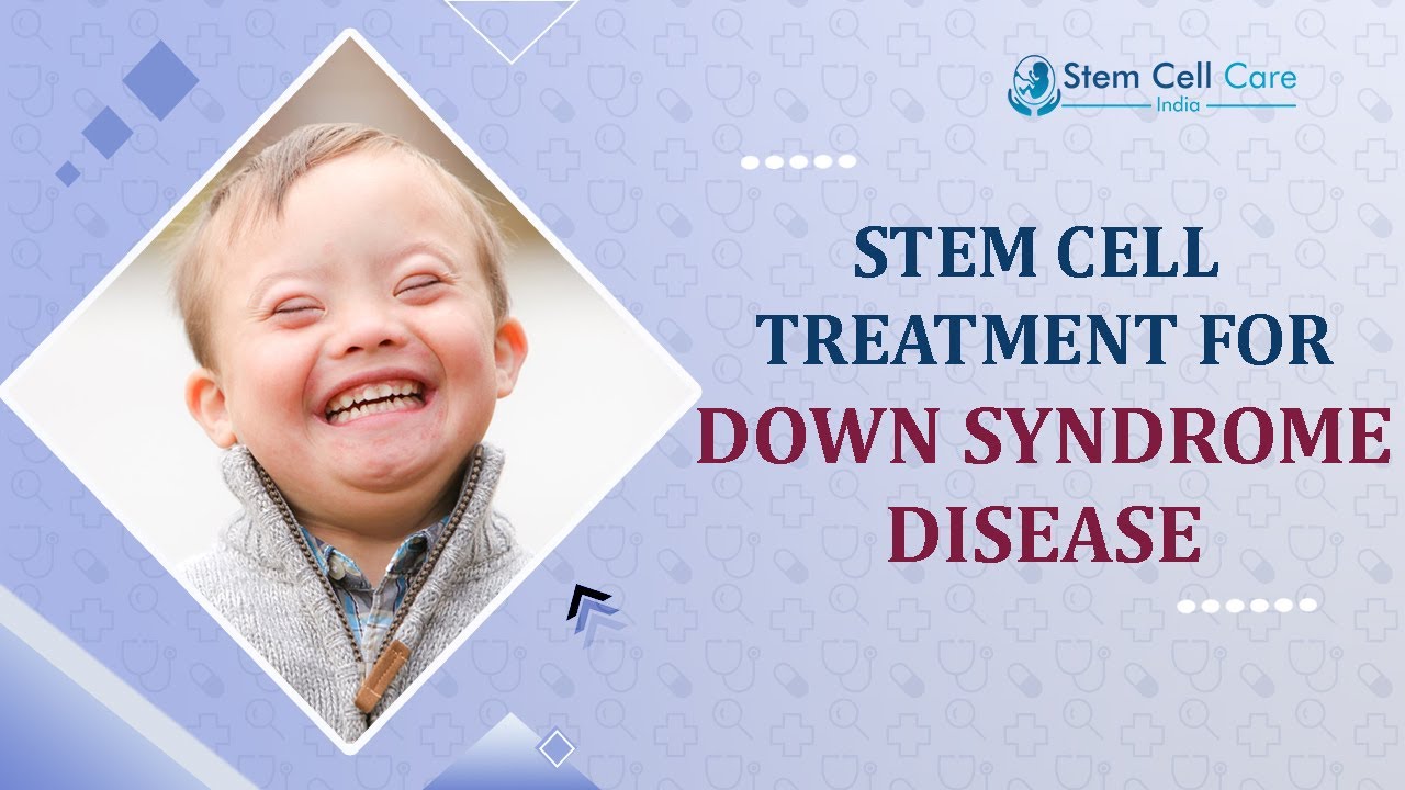 Down Syndrome | Stem Cell Therapy For Down Syndrome | Best Treatment For Down Syndrom