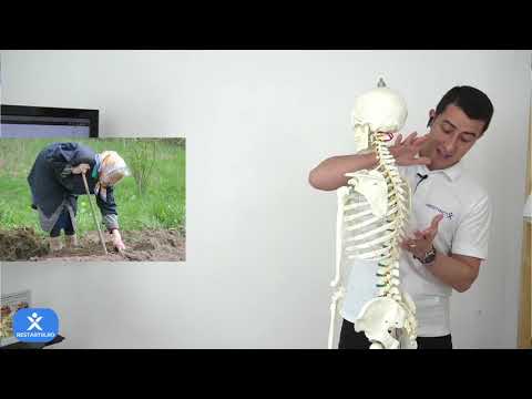Exerciții pentru spate cocoșat