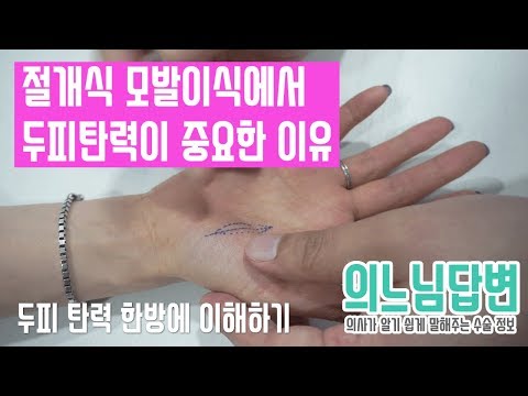 의느님답변????ㅣ두피탄력 한방에 이해하기(절개식 모발이식에서 두피탄력이 중요한 이유)