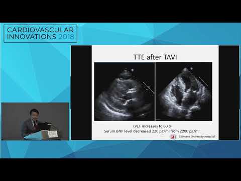CVI2018 Session: A case of successful emergency TAVI for a 92-year-old female - Hirotomo Sato MD