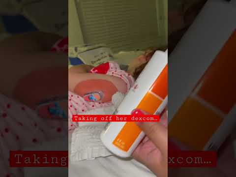 throwback #dexcomg6 #dexcom #type1diabetes #diabetictoddler #t1dmom