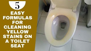 5 Easy Formulas for Cleaning Yellow Stains on a Toilet Seat