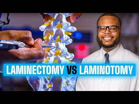 Laminectomy vs Laminotomy | Spinal Decompression Explained