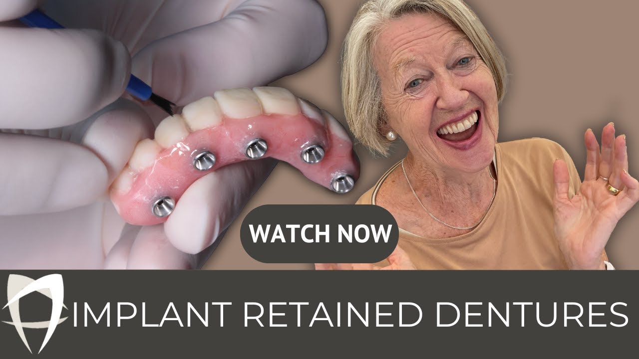 Alexandra - Implant-Retained Dentures (Lower) + Complete Denture (Upper)