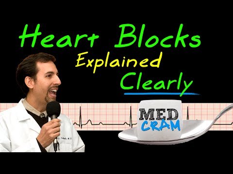 Heart Blocks on EKG / ECG Explained Clearly (MedCram EKG / ECG Course)
