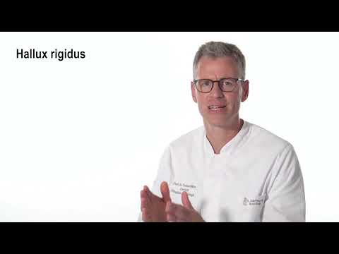 Fuß - Hallux rigidus, Prof. Dr. Thomas Kälicke, GFO Kliniken Bonn
