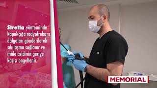 Ameliyatsız Reflü Tedavisi: Stretta