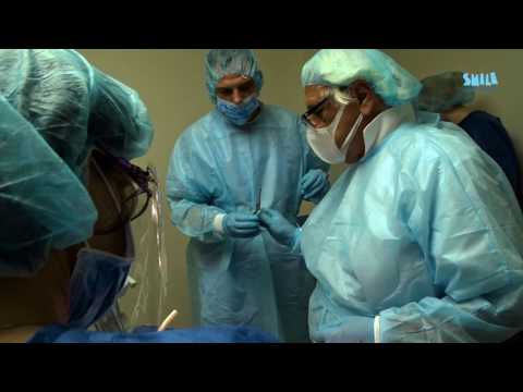 Full mouth restoration with basal dental implants in Smile Dental Services - Bulgaria (All-on-4)