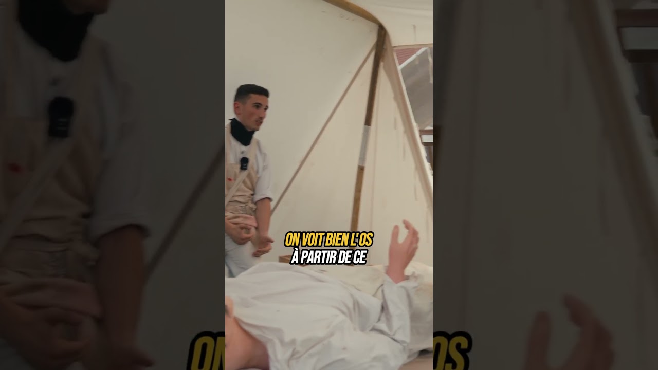 La chirurgie sous le premier empire : l'amputation  #napoleon #histoire #france