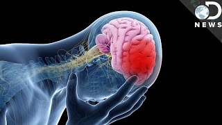 This Is What A Stroke Does To Your Body