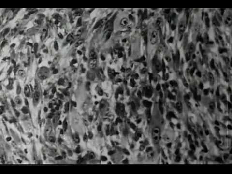 The Search for Cancer Viruses (NET Science and USPHS, 1966)