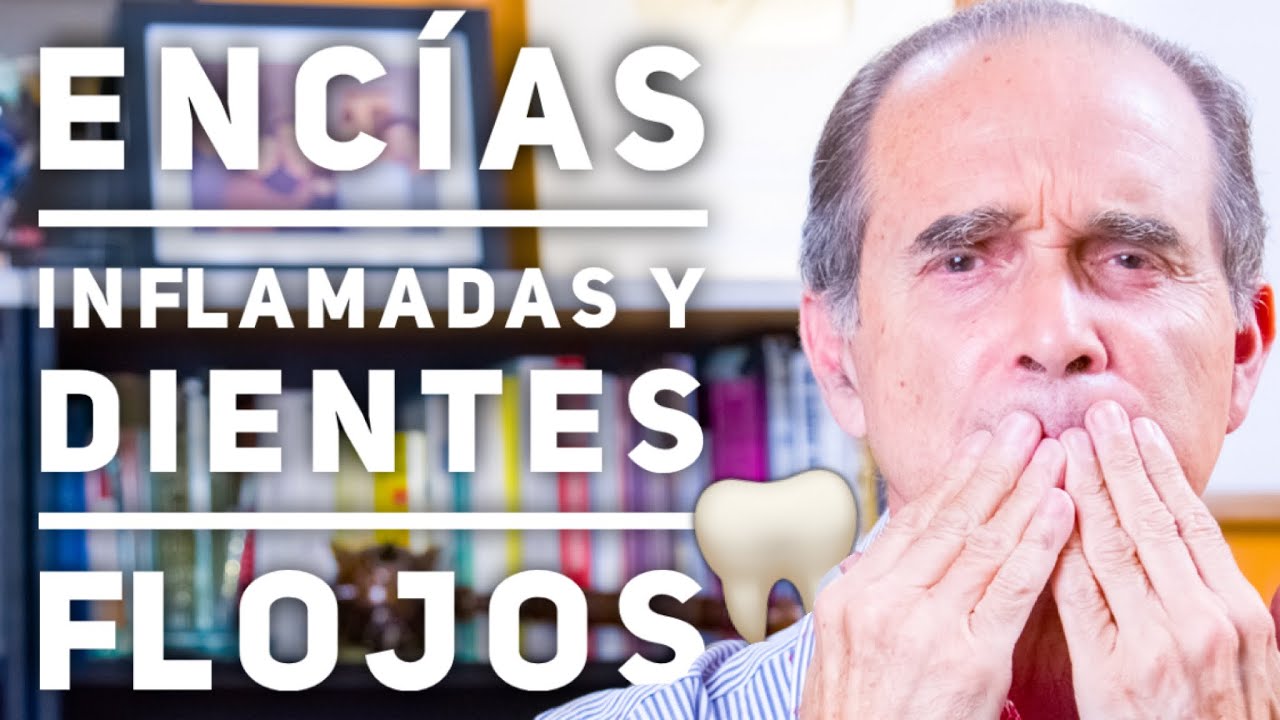 Watch Episodio #1900 Encías Inflamadas Y Dientes Flojos Now Episodio #1900 Encías Inflamadas Y Dientes Flojos