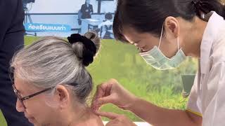 ฟื้นฟูสุขภาพด้วยการฝังเข็ม ศาสตร์แพทย์แผนจีน