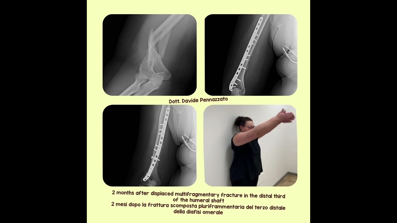 Davide Pennazzato-33