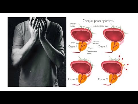 Показания к замене сустава Не разгибаются локтевые суставы