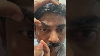 Download lagu Meibomian Gland Dysfunction Eyelid Massage | Best Eyelid Massage Guide (In Hindi) | Vision Eye mp3