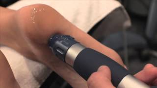 Shockwave Therapy for Foot Pain