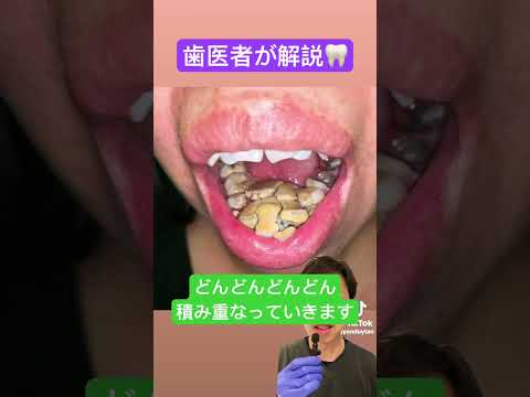 猫の歯石を除去するためのヒント