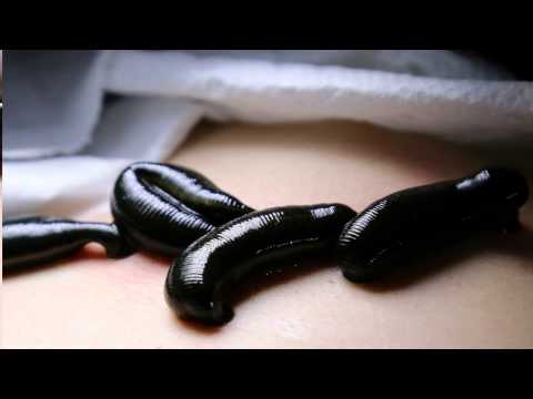 Turboslim control timbang presyo Kung magkano ang maaari kang mawalan ng timbang sa review repolyo