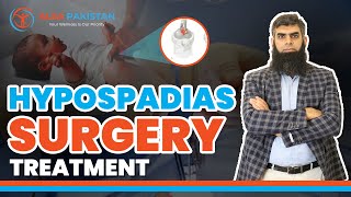 Treatment Strategy of Hypospadias Surgery in Boys |  Hypospadias Boys |  Alsa Pakistan