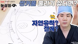 [Dr.허니팁] 자연유착?부분절개?절개?????쌍커풀 풀리기 싫다면?