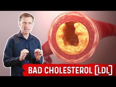 The Real Purpose of Cholesterol – Dr Berg on Cholesterol levels Part 1