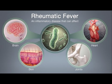RHEUMATIC FEVER, RHEUMATIC HEART DISEASE (RHD) & INFECTIVE ENDOCARDITIS (IE) || CARDIO PATHOLOGY