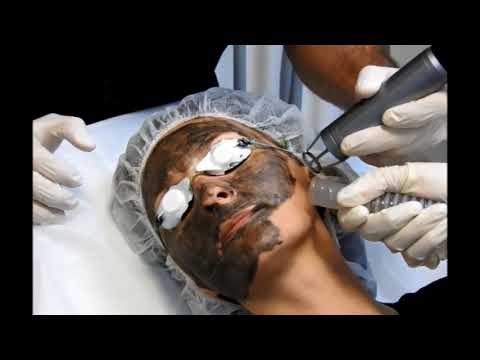 Come togliere una macchia scura su pelle da unustione I mezzi per candeggiare di pelle di un corpo e la persona