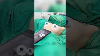 Download lagu Breast augmentation surgery highlight this morning at Dr.KOKO. mp3