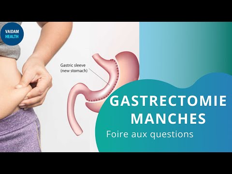 PONTAGE GASTRIQUE