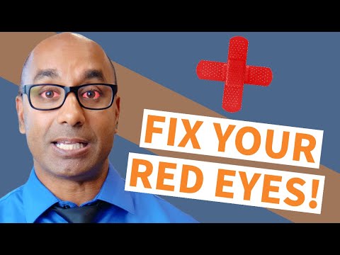 How to get rid of Red Eyes | 3 Underlying Causes and How to Fix it!
