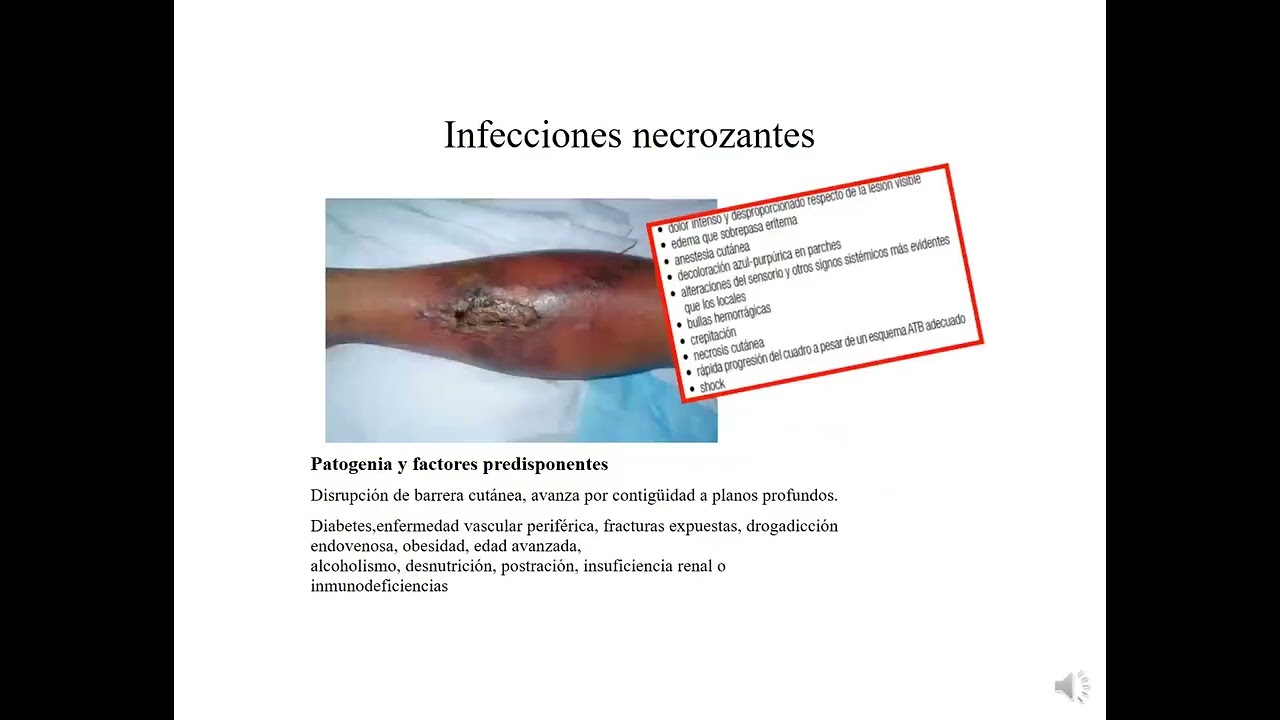 Seminario 4 - Mucocutaneas II - Micro 2 Cat 1