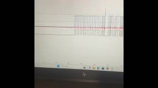 Diagnosing CAN Bus Networks with Picoscope (Shorts and Opens) On A 2013 Ford Fiesta